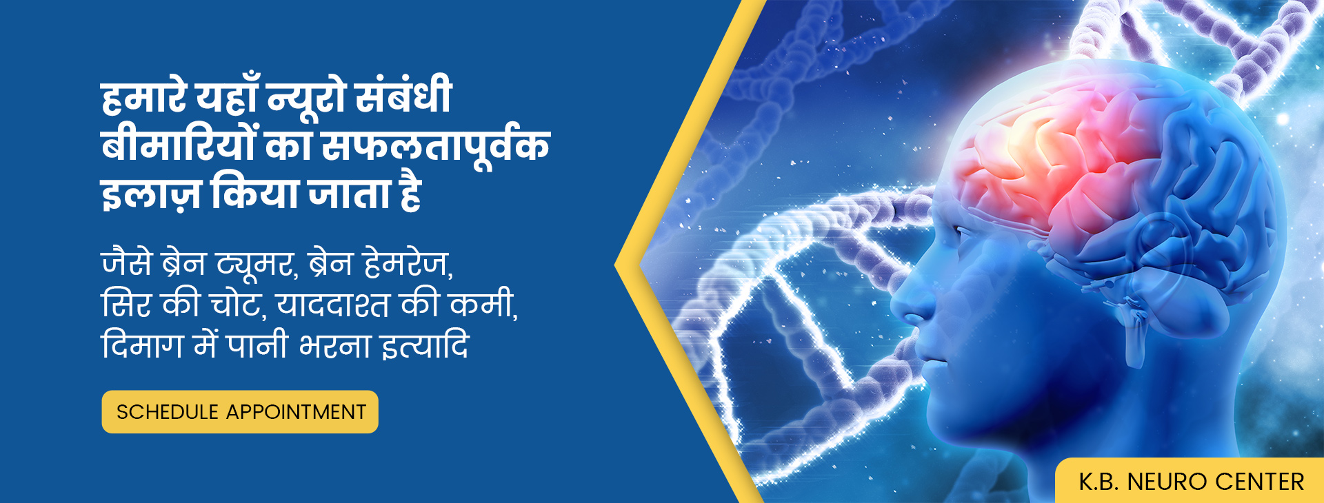 Dr. Bhupendra Bhatia, MBBS,MD,DM (NEUROLOGY)- KB Neuro Center